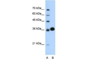 WB Suggested Anti-CDK6  Antibody Titration: 0. (CDK6 anticorps  (C-Term))