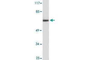 Western blot analysis of HUVEC cell lysate with CYP24A1 polyclonal antibody .