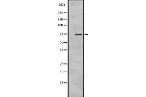 Western blot analysis of KIFC1 using K562 whole cell lysates