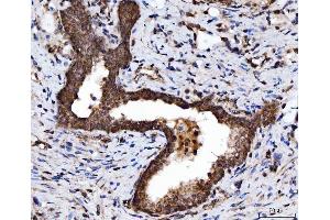 IHC analysis of TRBP/TARBP2 using anti-TRBP/TARBP2 antibody (ABIN7600548). (TARBP2 anticorps  (AA 20-366))