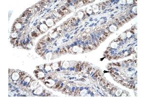 CCL18 antibody was used for immunohistochemistry at a concentration of 4-8 ug/ml to stain Epithelial cells of intestinal villus (arrows) in Human Intestine. (CCL18 anticorps  (Middle Region))