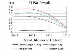 Black line: Control Antigen (100 ng), Purple line: Antigen(10 ng), Blue line: Antigen (50 ng), Red line: Antigen (100 ng),