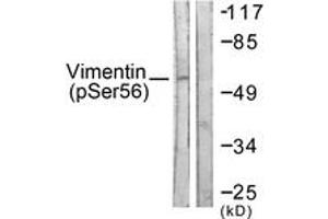 Western blot analysis of extracts from A549 cells treated with Nocodazole 1ug/ml 16h, using Vimentin (Phospho-Ser56) Antibody. (Vimentin anticorps  (pSer56))