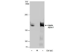 IP Image Immunoprecipitation of Liprin alpha 1 protein from A431 whole cell extracts using 5 μg of Liprin alpha 1 antibody [N1N2], N-term, Western blot analysis was performed using Liprin alpha 1 antibody [N1N2], N-term, EasyBlot anti-Rabbit IgG  was used as a secondary reagent. (PPFIA1 anticorps  (N-Term))