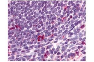 Immunohistochemical staining of spleen lymphocytes using antibody ABIN122022 (CCR2 anticorps)