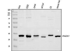 Western blot analysis of Rad51 using anti-Rad51 antibody (ABIN3043560).