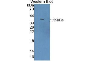 Western blot analysis of the recombinant protein. (PDE12 anticorps  (AA 290-602))