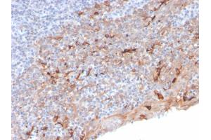 Formalin-fixed, paraffin-embedded human Tonsil stained with TIM3 Mouse Monoclonal Antibody (TIM3/3113). (TIM3 anticorps  (AA 22-202))