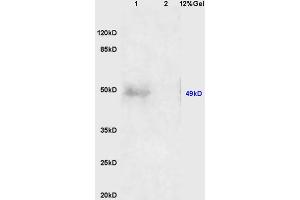 Lane 1: human colon carcinoma lysates Lane 2: mouse embryo lysates probed with Anti AVPR2 Polyclonal Antibody, Unconjugated (ABIN1386214) at 1:200 in 4 °C. (GDF9 anticorps  (AA 301-400))