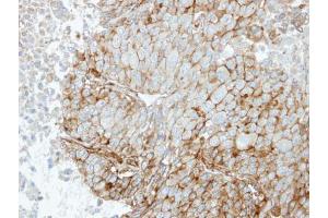 IHC-P Image Immunohistochemical analysis of paraffin-embedded Hep3B xenograft, using RRAS, antibody at 1:100 dilution.