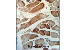 Antibody (N-term) (ABIN653752 and ABIN2843052) IHC analysis in formalin fixed and paraffin embedded human skeletal muscle tissue followed by peroxidase conjugation of the secondary antibody and DAB staining.