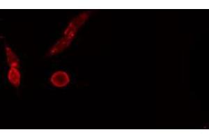 ABIN6274694 staining NIH-3T3 cells by IF/ICC. (Mre11 anticorps  (C-Term))