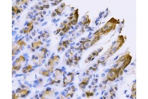 IHC analysis of Tspan-8/Tspan8 using anti-Tspan-8/Tspan8 antibody (ABIN7599681).