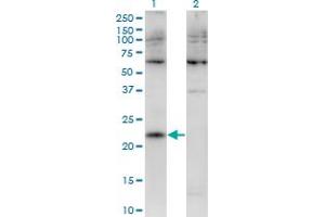 Western Blot analysis of CMTM4 expression in transfected 293T cell line by CMTM4 monoclonal antibody (M02), clone 1B9. (CMTM4 anticorps  (AA 173-234))