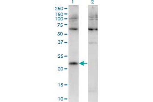 CMTM4 anticorps  (AA 173-234)