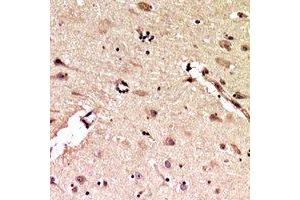 Immunohistochemical analysis of ALB staining in human brain formalin fixed paraffin embedded tissue section. (Albumin anticorps  (C-Term))