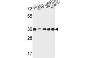 Western Blotting (WB) image for anti-Torsin Family 1, Member B (Torsin B) (TOR1B) antibody (ABIN3002128)