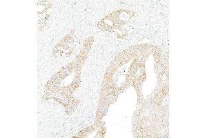 Immunohistochemistry (IHC) image for anti-Met Proto-Oncogene (MET) (C-Term) antibody (ABIN7795683) (Recombinant c-MET anticorps  (C-Term))