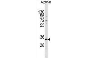 Western Blotting (WB) image for anti-TGFB-Induced Factor Homeobox 2-Like, X-Linked (TGIF2LX) antibody (ABIN3000268) (TGIF2LX anticorps)