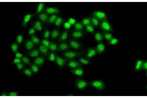 Immunofluorescence analysis of A549 cells using PHF11 Polyclonal Antibody