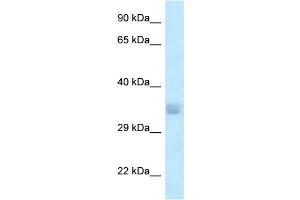 WB Suggested Anti-ACOT8 Antibody Titration: 1. (ACOT8 anticorps  (N-Term))