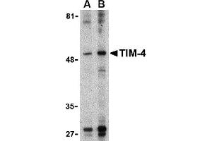 Western Blotting (WB) image for anti-T-Cell Immunoglobulin and Mucin Domain Containing 4 (TIMD4) (Middle Region) antibody (ABIN1031125) (TIMD4 anticorps  (Middle Region))