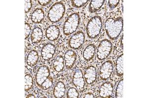 IHC analysis of SNRNP27 using anti-SNRNP27 antibody (ABIN7599614). (SNRNP27 anticorps  (AA 100-155))