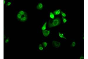 Immunofluorescence staining of Hela Cells with ABIN7127591 at 1:50, counter-stained with DAPI.