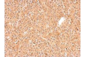 IHC-P Image GGPS1 antibody detects GGPS1 protein at cytosol on BT483 xenograft by immunohistochemical analysis.