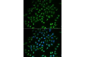 Immunofluorescence analysis of  cells using H antibody (ABIN6128002, ABIN6141597, ABIN6141598 and ABIN6222828).