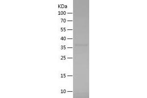 Western Blotting (WB) image for Actin, alpha 2, Smooth Muscle, Aorta (ACTA2) (AA 3-100) protein (His-IF2DI Tag) (ABIN7121658)