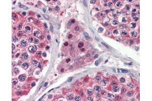 IDH1 antibody was used for immunohistochemistry at a concentration of 4-8 ug/ml. (IDH1 anticorps)