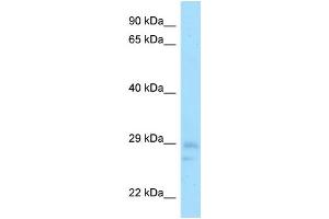 Host: Rabbit Target Name: Cnot8 Antibody Dilution: 1. (CNOT8 anticorps  (N-Term))