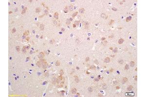 Formalin-fixed and paraffin embedded rat brain labeled with Anti-VGLUT2 Polyclonal Antibody, Unconjugated  at 1:200 followed by conjugation to the secondary antibody and DAB staining.