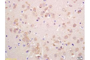 Formalin-fixed and paraffin embedded rat brain labeled with Anti-VGLUT2 Polyclonal Antibody, Unconjugated  at 1:200 followed by conjugation to the secondary antibody and DAB staining. (Solute Carrier Family 17 (Vesicular Glutamate Transporter), Member 6 (SLC17A6) (AA 1-50) anticorps)