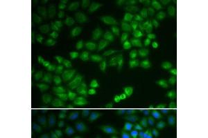 Immunofluorescence analysis of MCF-7 cells using RPL5 Polyclonal Antibody (RPL5 anticorps)