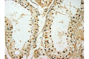 IHC(P): Human Testis Tissue (ODC1 anticorps)