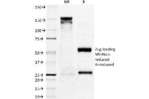 SDS-PAGE Analysis Purified Bcl-x Mouse Monoclonal Antibody (2H12).
