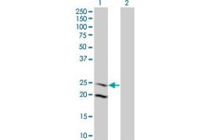 Western Blot analysis of IL6 expression in transfected 293T cell line by IL6 monoclonal antibody (M09), clone 3F12. (IL-6 anticorps  (AA 29-212))