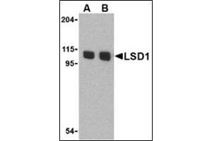 Western blot analysis of LSD1 in P815 cell lysate with this product at (A) 1 and (B) 2 μg/ml. (LSD1 anticorps  (N-Term))
