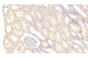 Detection of MMP1 in Human Kidney Tissue using Polyclonal Antibody to Matrix Metalloproteinase 1 (MMP1) (MMP1 anticorps  (AA 98-275))