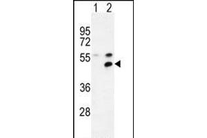 Western blot analysis of P1 (arrow) using rabbit polyclonal P1 Antibody (Center) (ABIN654665 and ABIN2844361). (MPP1 anticorps  (AA 301-327))
