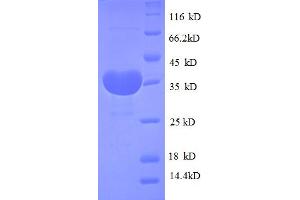 SDS-PAGE (SDS) image for Mitochondrially Encoded Cytochrome B (MT-CYB) (AA 1-98), (full length) protein (GST tag) (ABIN5712043) (Cytochrome b Protein (AA 1-98, full length) (GST tag))