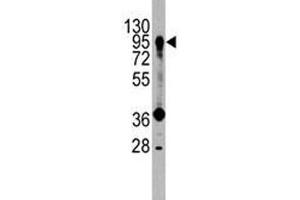 Western blot analysis of PROX1 antibody and HepG2 lysate.
