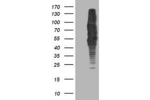 HEK293T cells were transfected with the pCMV6-ENTRY control (Left lane) or pCMV6-ENTRY DLD (Right lane) cDNA for 48 hrs and lysed. (DLD anticorps)