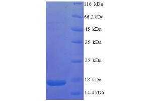 SDS-PAGE (SDS) image for Vpx Protein (VPX) (AA 1-113), (full length) protein (His tag) (ABIN5710828) (Vpx Protein (VPX) (AA 1-113), (full length) protein (His tag))
