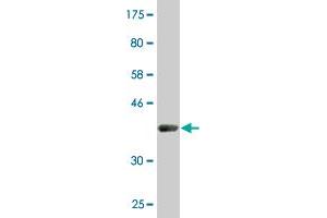 Western Blot detection against Immunogen (38.
