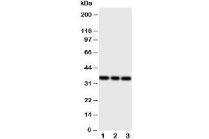 Western blot testing of BSP antibody and Lane 1:  rat liver;  2: rat brain;  3: rat kidney tissue lysate. (IBSP anticorps  (C-Term))