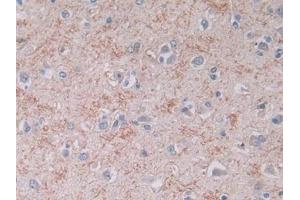 Detection of BNP in Human Cerebrum Tissue using Monoclonal Antibody to Brain Natriuretic Peptide (BNP) (BNP anticorps)