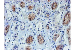 Immunohistochemistry (IHC) image for anti-Docking Protein 7 (DOK7) antibody (ABIN1497885)
